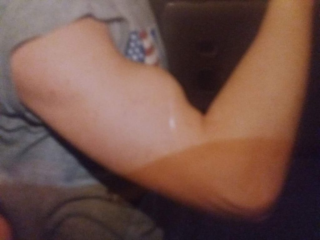 Biceps